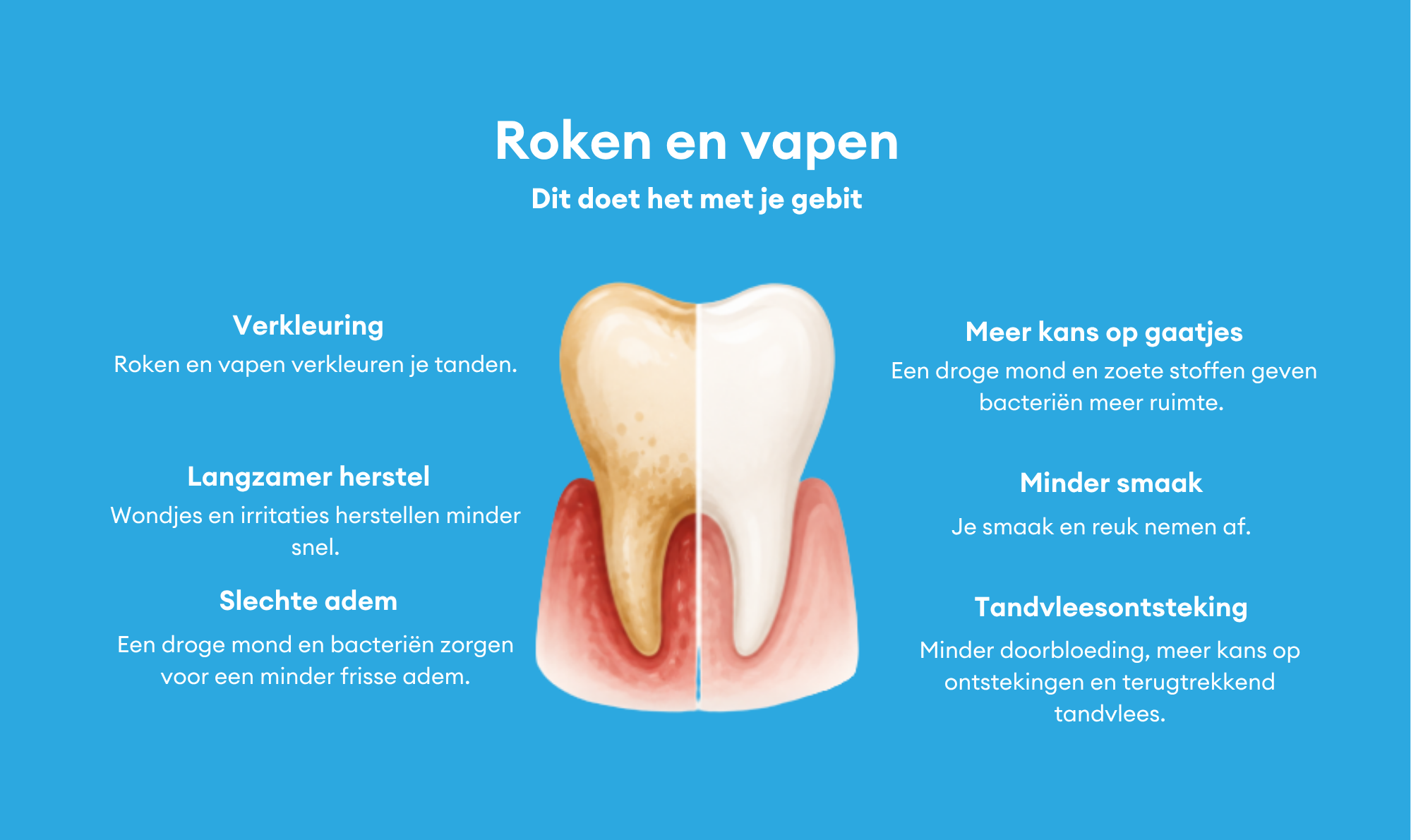 Tanden, tandvlees en stoppen met roken of vapen